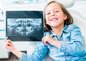Рентген зубов у ребенка — все, что нужно знать